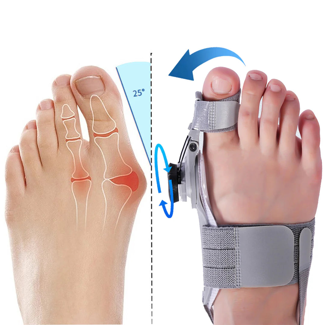 True Life Medi Bunion Fix - Natural At - Home Bunion Relief